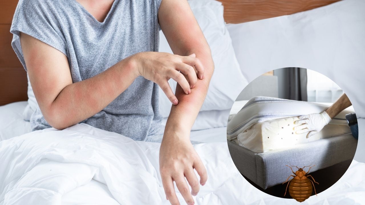 Are bed bug bites itchy: A comprehensive analysis